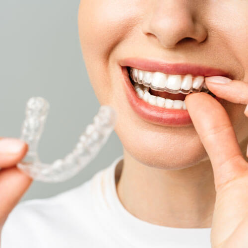 Mulher segurando aparelhos invisalign em clínica odontológica em Guarulhos